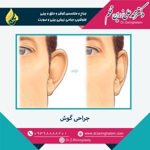 جراحی گوش در مشهد - دکتر زرین قلم