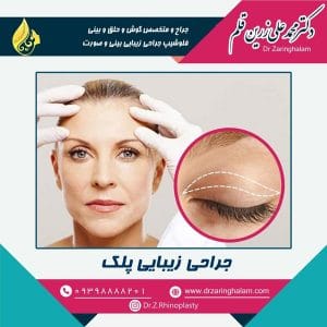 مراقبت های بعد از جراحی پلک - دکتر زرین قلم