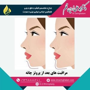 مراقبت های بعد از پروتز چانه - دکتر زرین قلم
