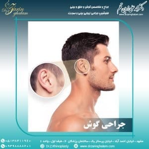 جراحی گوش در مشهد - دکتر زرین قلم
