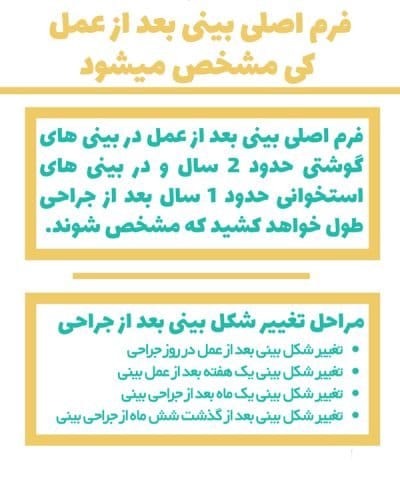 جراحی بینی استخوانی در مشهد - دکتر زرین قلم