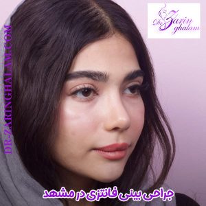 جراحی بینی فانتزی در مشهد - دکتر زرین قلم