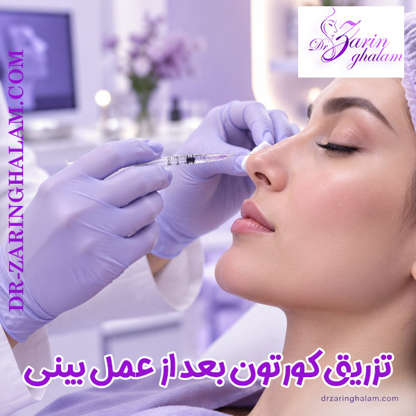 تزریق کورتون بعد از عمل بینی - دکتر زرین قلم