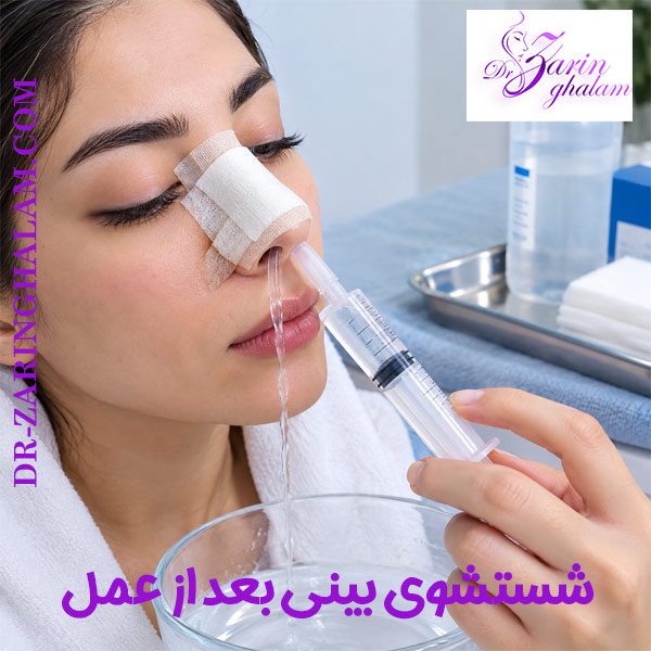 شستشوی بینی بعد از عمل - دکتر زرین قلم