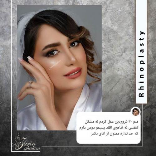 جراحی-بینی-372